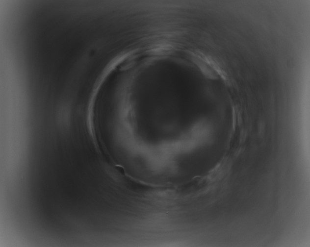 X0000100920147200807081158