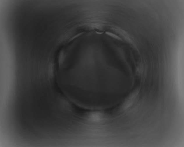 X0000100920462200807081155