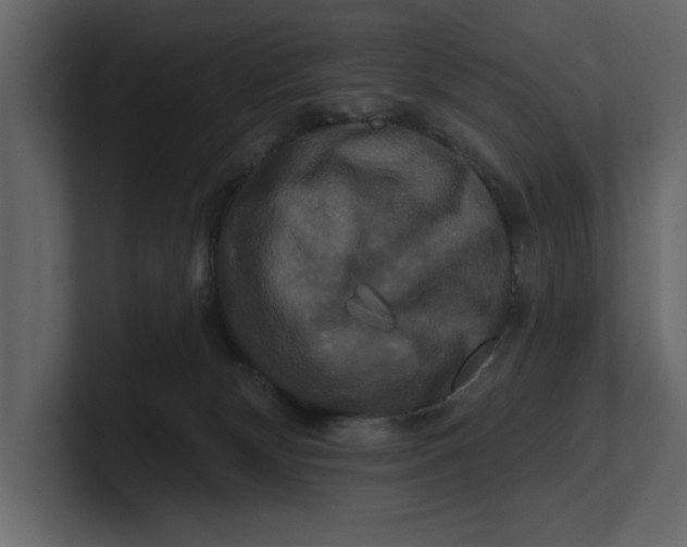 X0000100920132200807151230