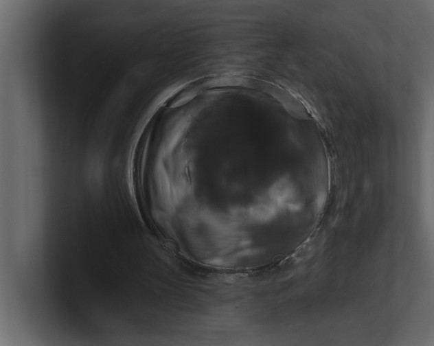 X0000100920147200807151229