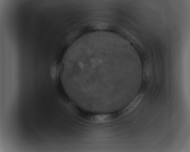 X0000100920172200807151230