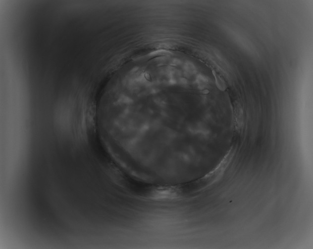 X0000100920175200807151230