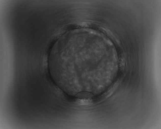 X0000100920466200807151226