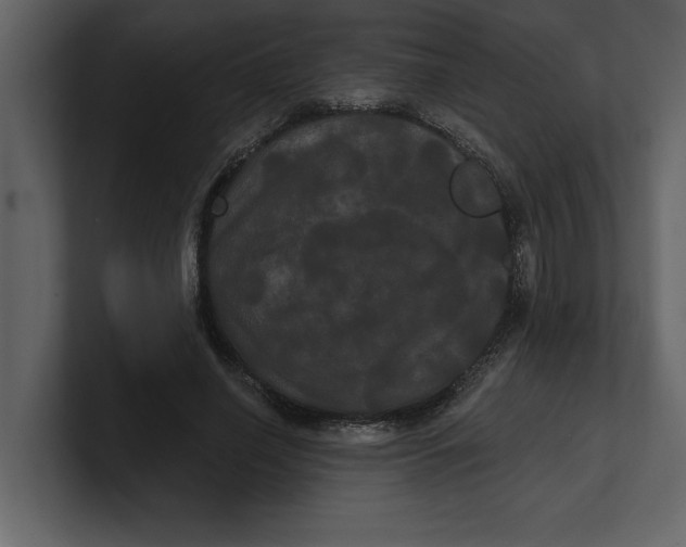 X0000100920638200807151223