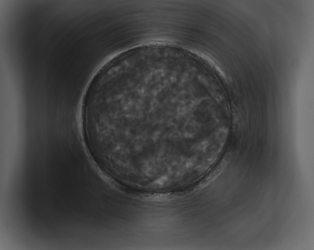 X0000100921038200807151217