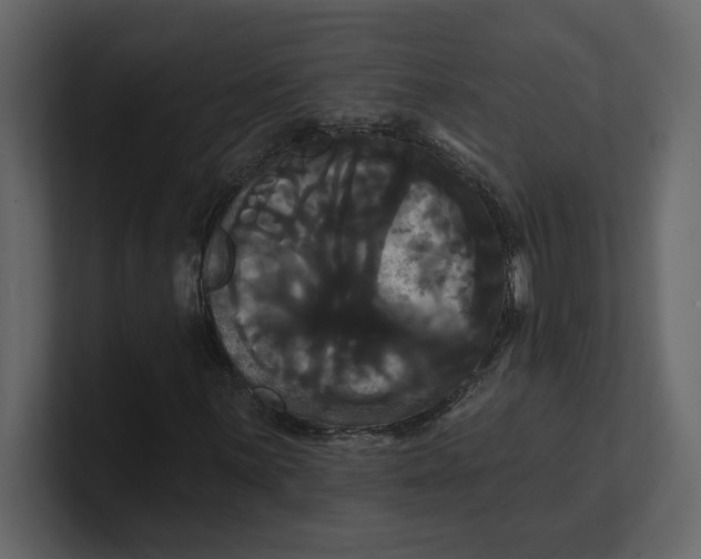 X0000100921059200807151217