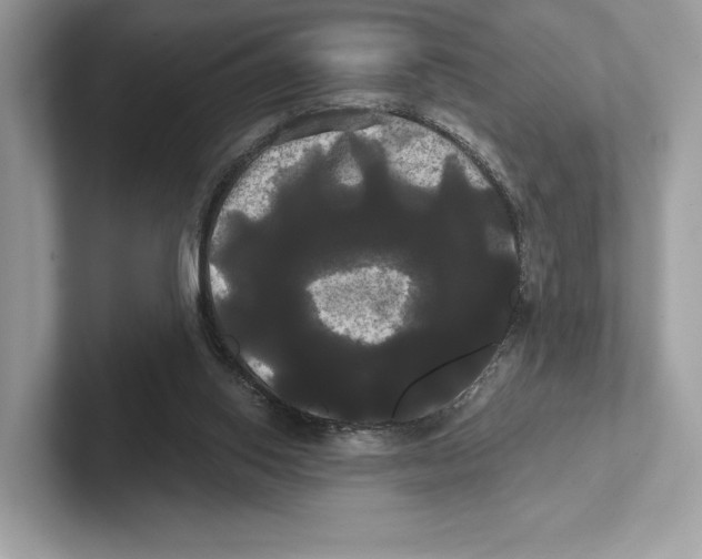 X0000100920062200807221125