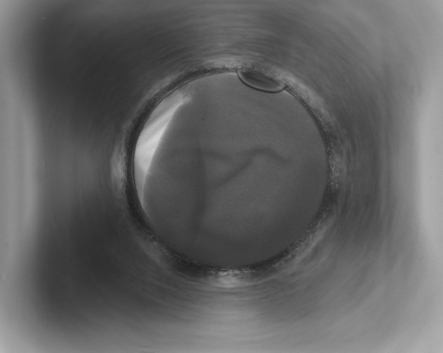 X0000100920064200807221125
