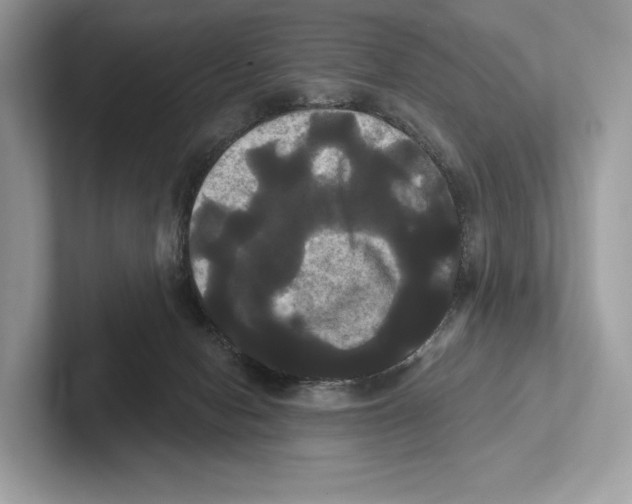 X0000100920078200807221125