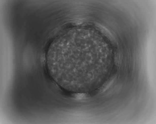 X0000100920085200807221125