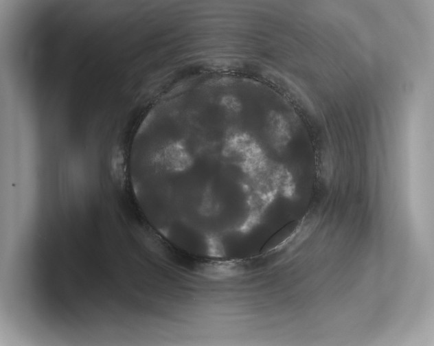 X0000100920086200807221125
