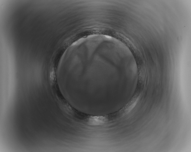 X0000100920137200807221124