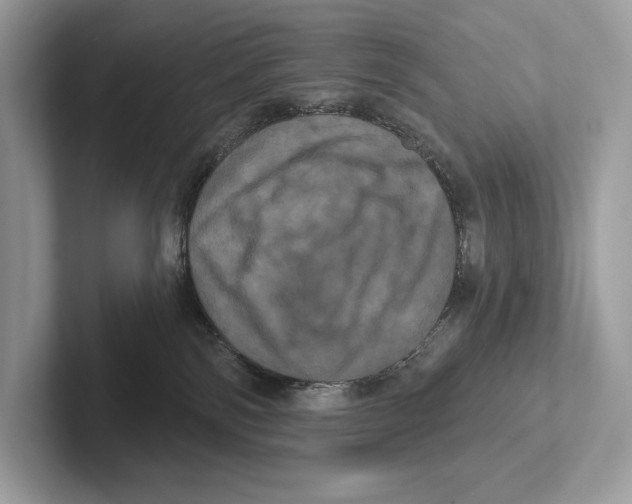X0000100920138200807221124