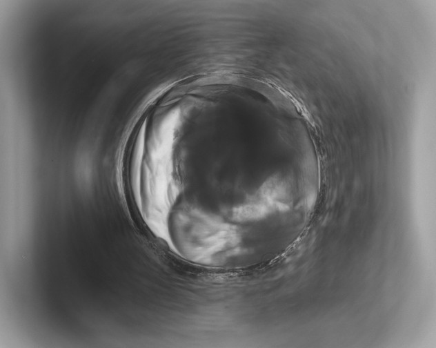 X0000100920147200807221123