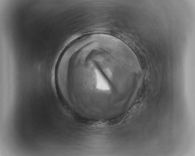 X0000100920148200807221123