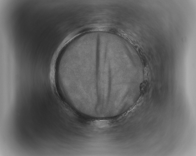 X0000100920150200807221123