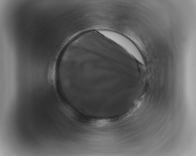 X0000100920156200807221123