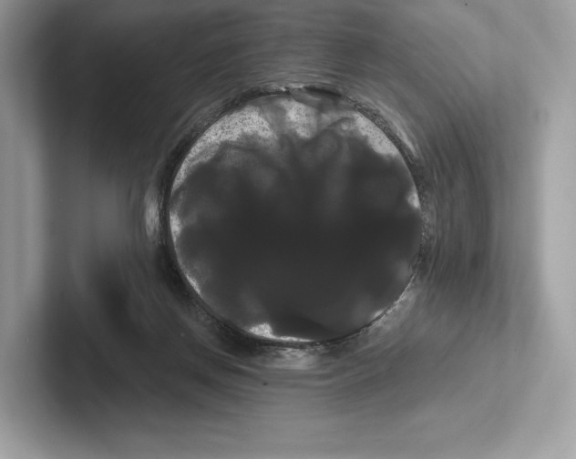 X0000100920166200807221123
