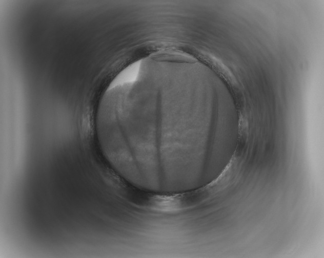 X0000100920170200807221123