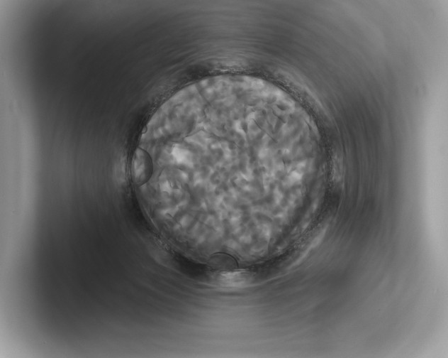 X0000100920173200807221123