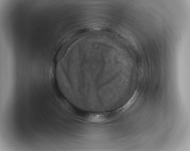 X0000100920174200807221123