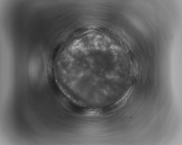 X0000100920175200807221123