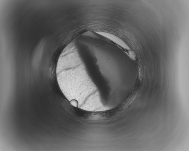X0000100920177200807221123