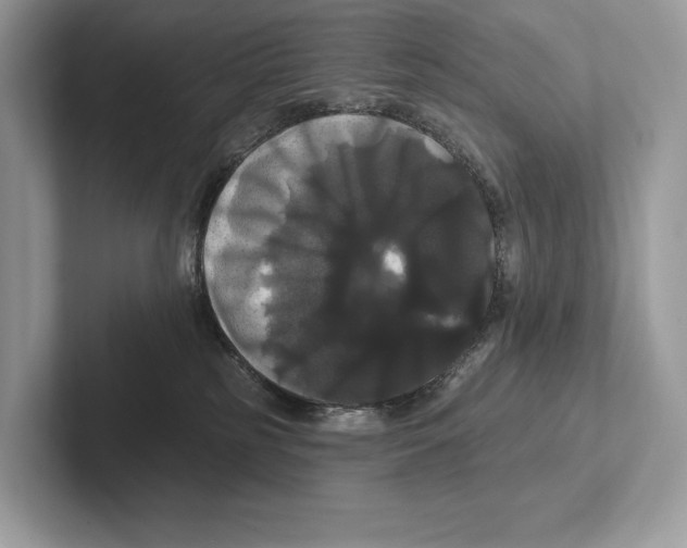 X0000100920185200807221124