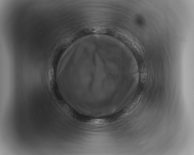 X0000100920748200807221115