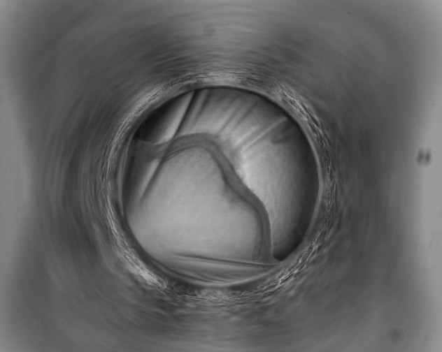 X0000100930145200807011229