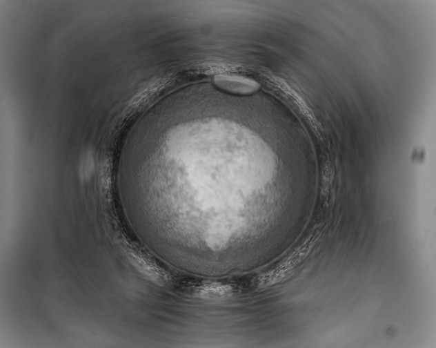 X0000100930257200807011228