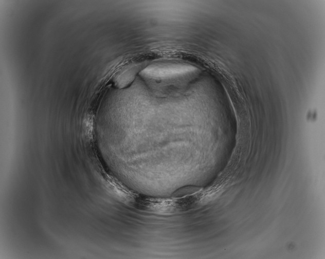 X0000100930288200807011229