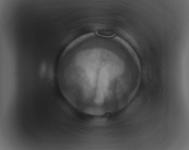 X0000100930257200807081219