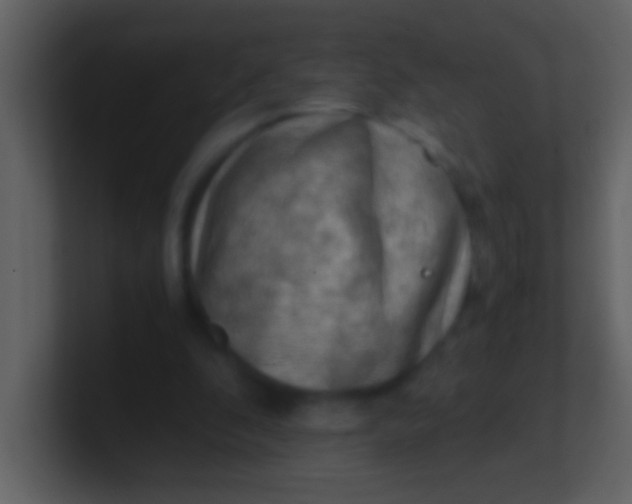 X0000100930296200807081219