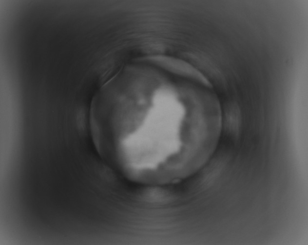 X0000100930616200807081214