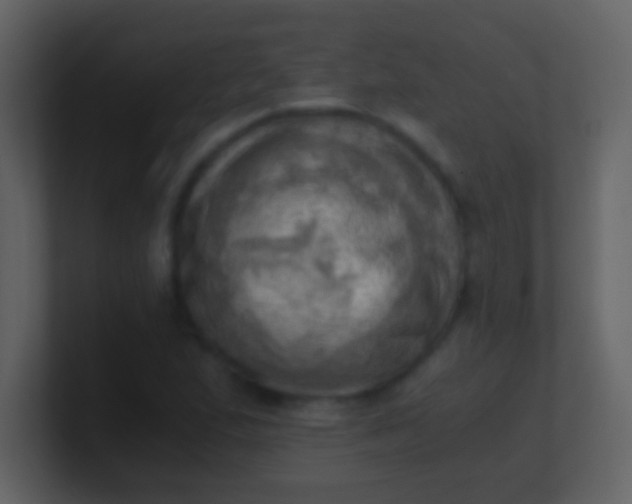 X0000100931167200807081206