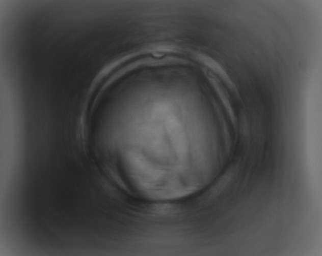 X0000100931176200807081206