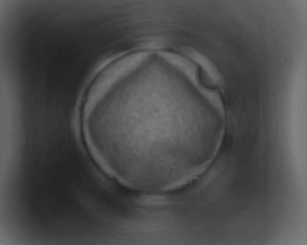 X0000100931187200807081206