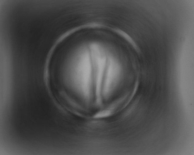 X0000100931335200807081204