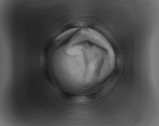 X0000100930322200807151250