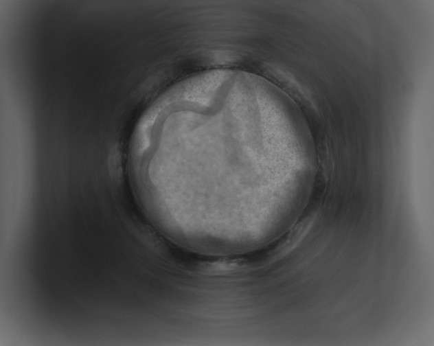 X0000100930366200807151249