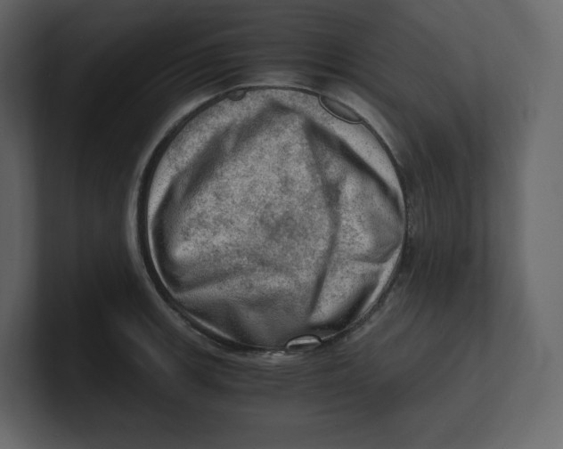 X0000100931139200807151238