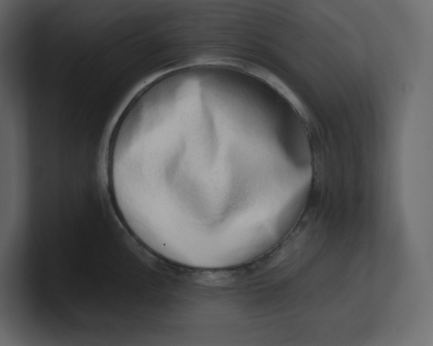 X0000100931148200807151238