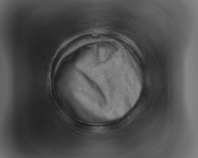 X0000100931176200807151237