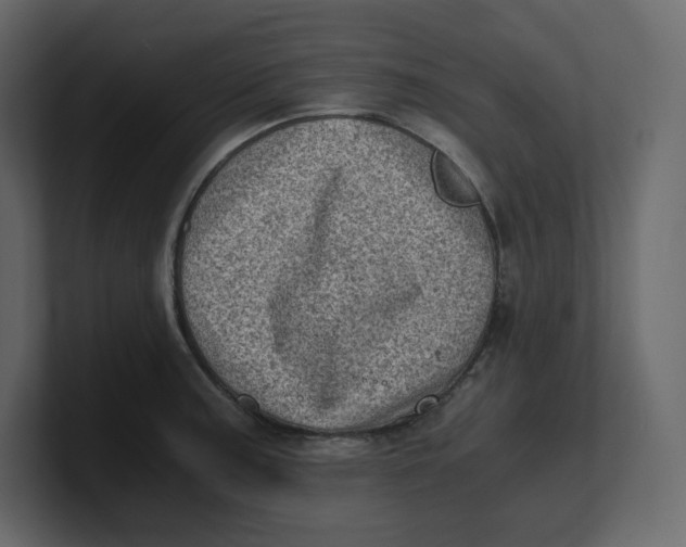 X0000100931187200807151237