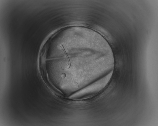 X0000100931188200807151237