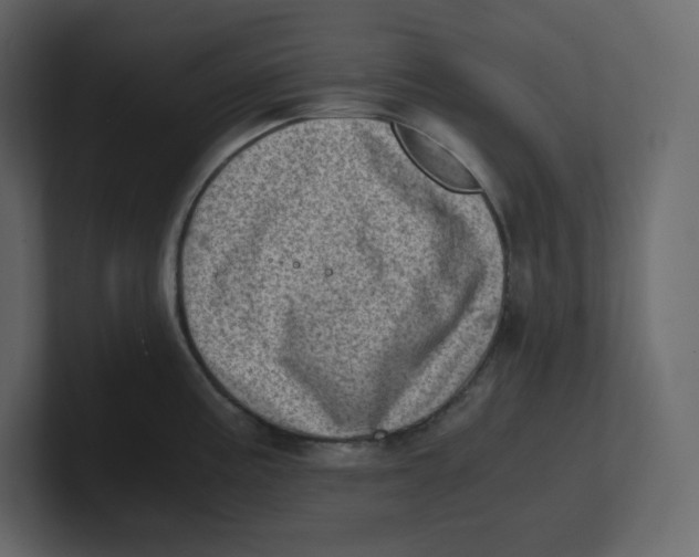 X0000100931195200807151237