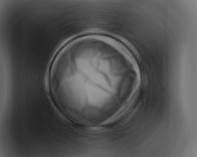 X0000100931295200807151236