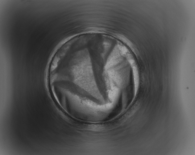 X0000100931379200807151235