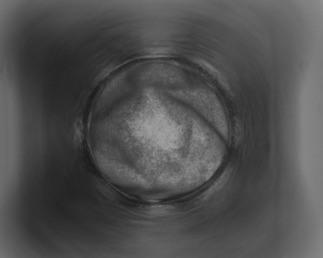 X0000100931449200807151233